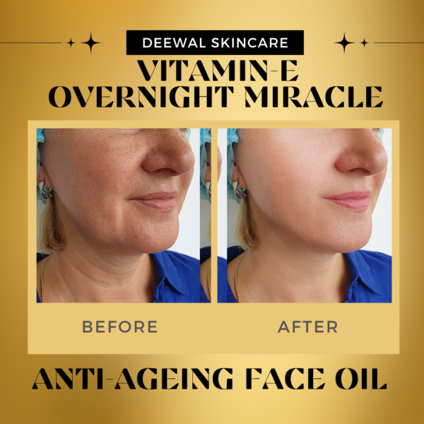 DEEWAL VITAMIN E FACE OIL - Image 7